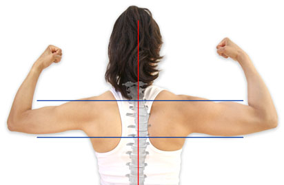 muscle imbalance diagram